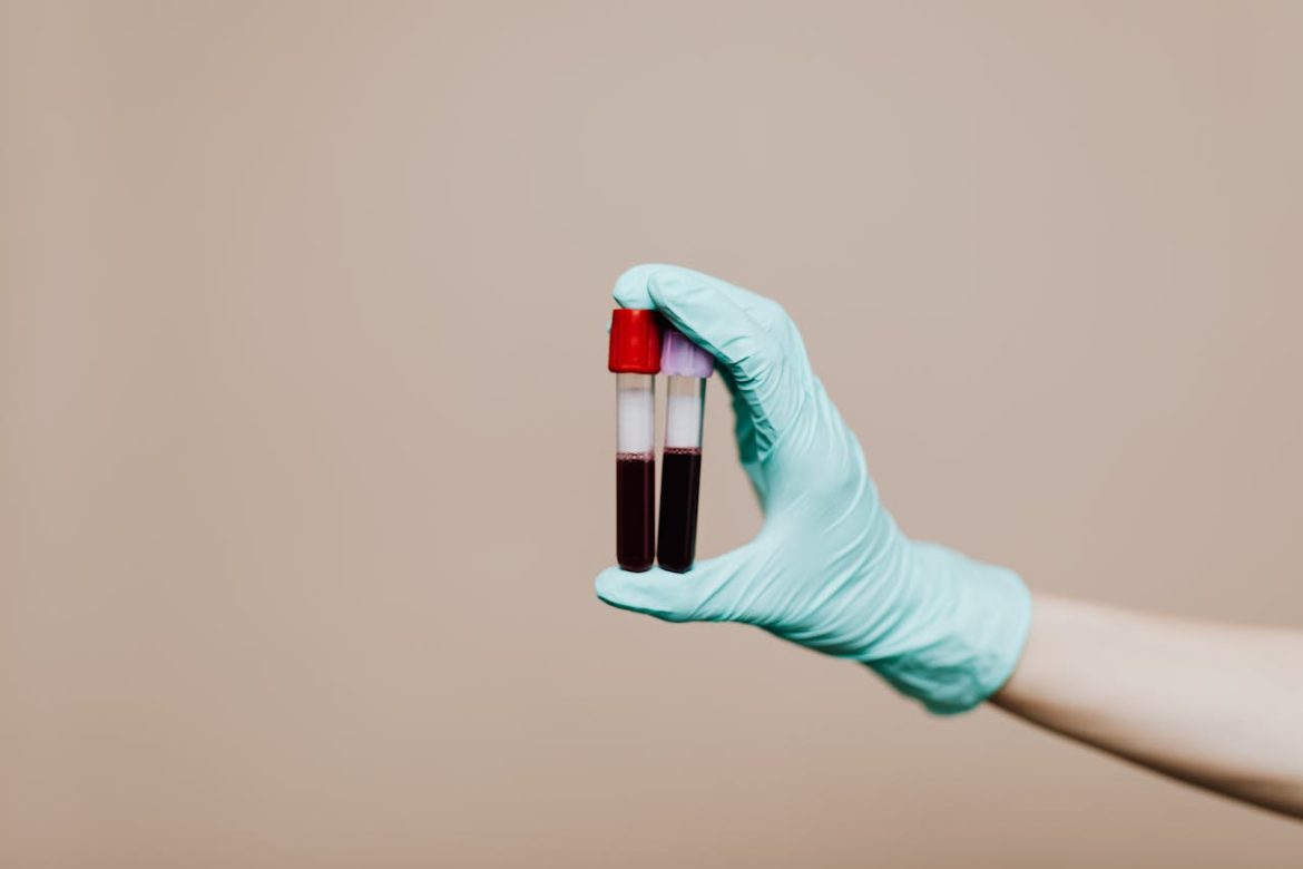 Blood thinner diet tips