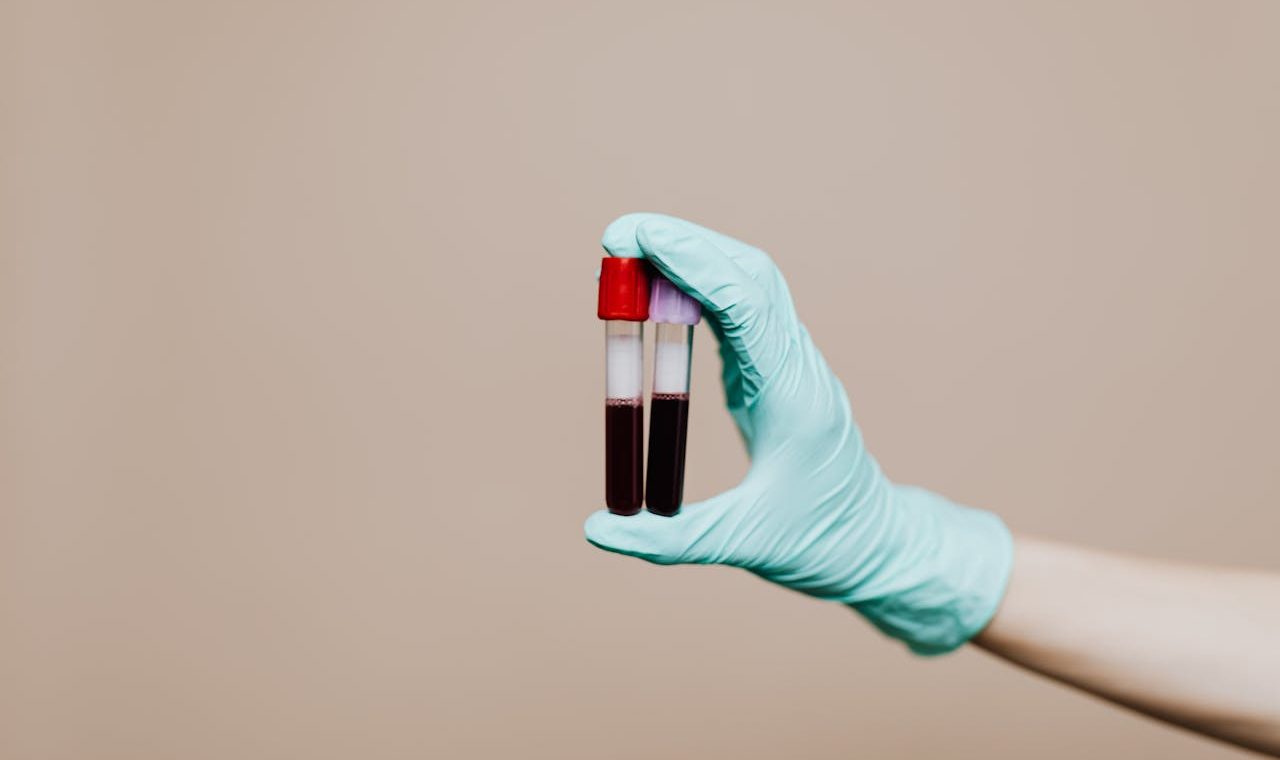 Blood thinner diet tips