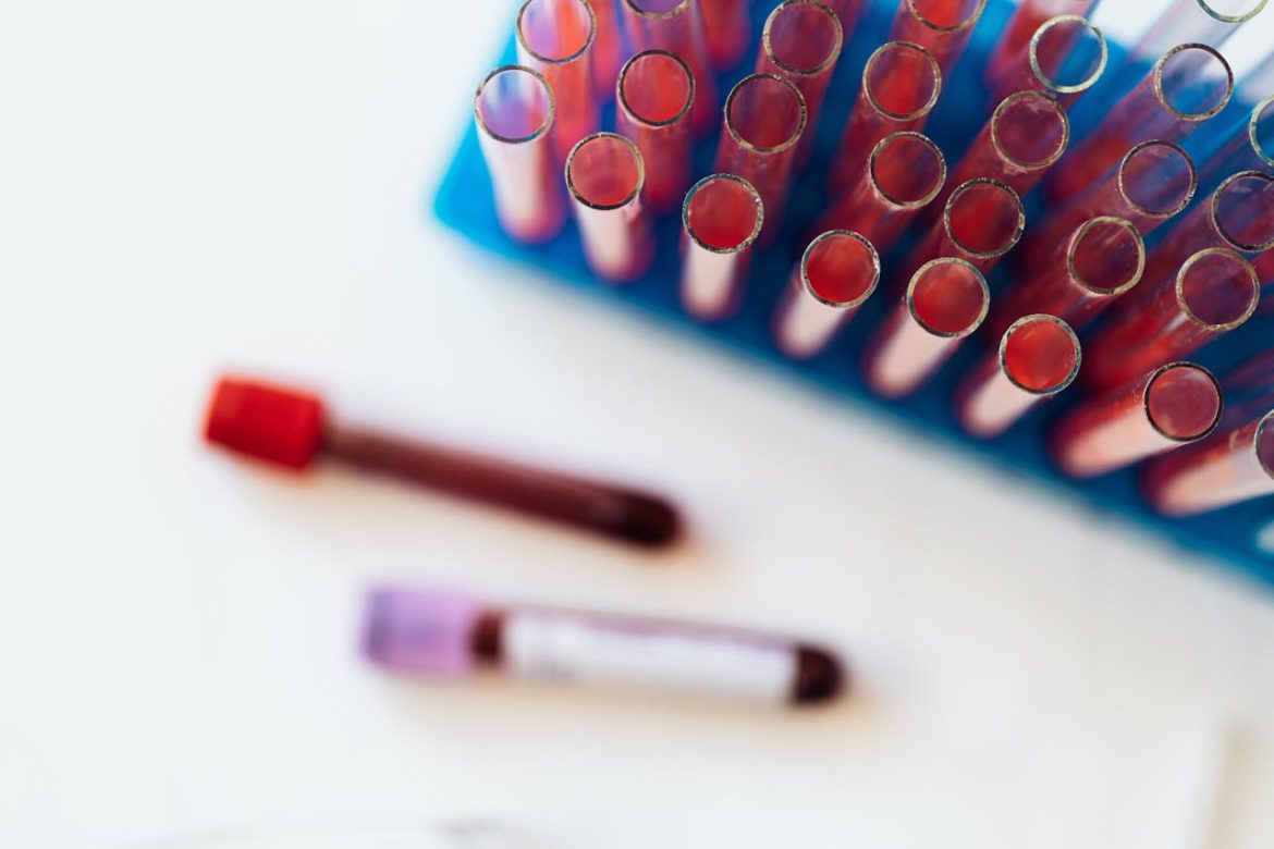 Blood thinners and meal frequency