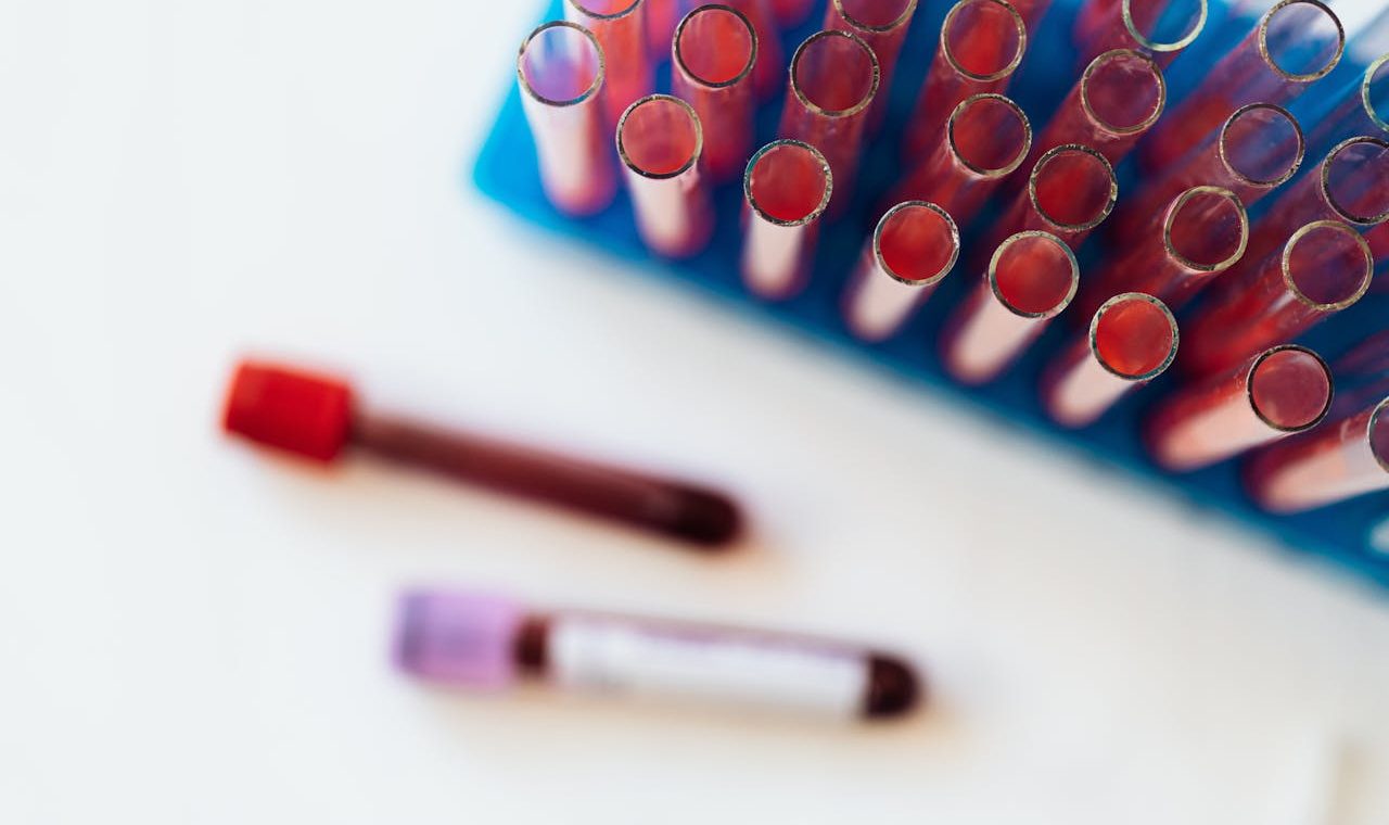 Blood thinners and meal frequency