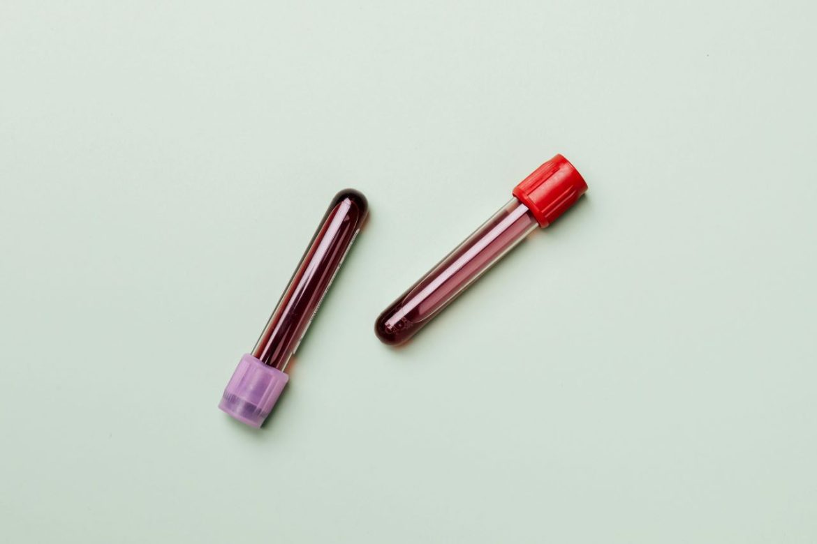 Blood thinners and protein intake