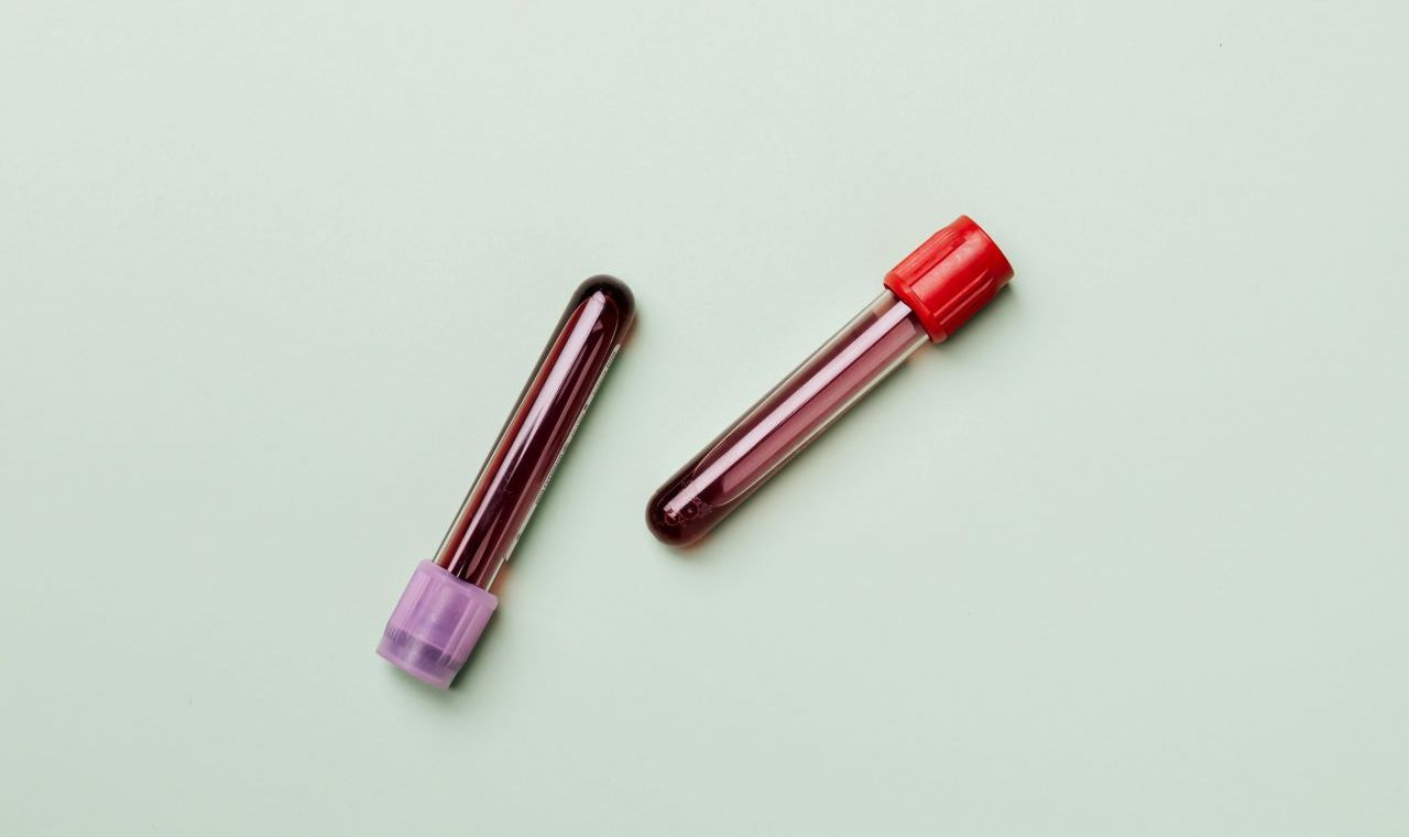 Blood thinners and protein intake