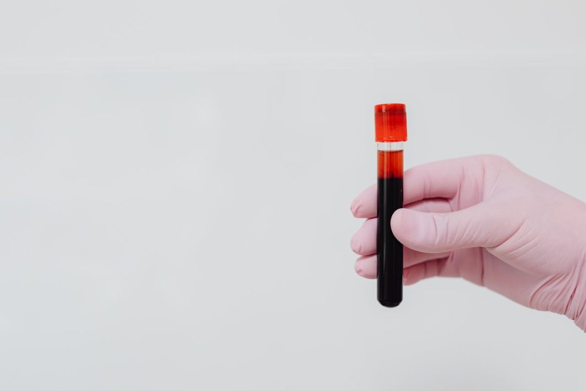 How to prevent bleeding while on blood thinners