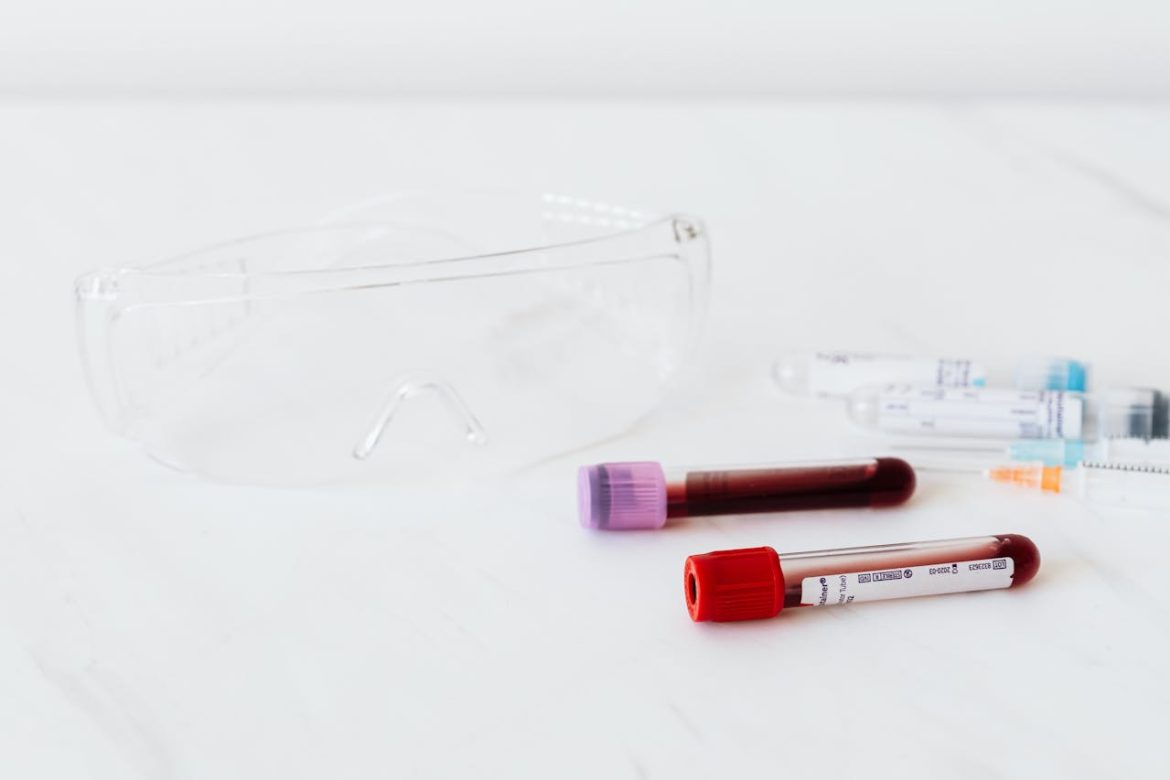 Blood thinners and bruising easily