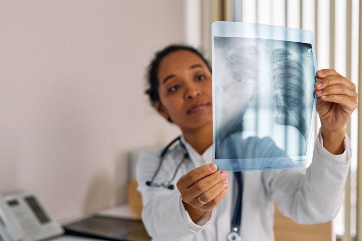 Flovent and lung function improvement