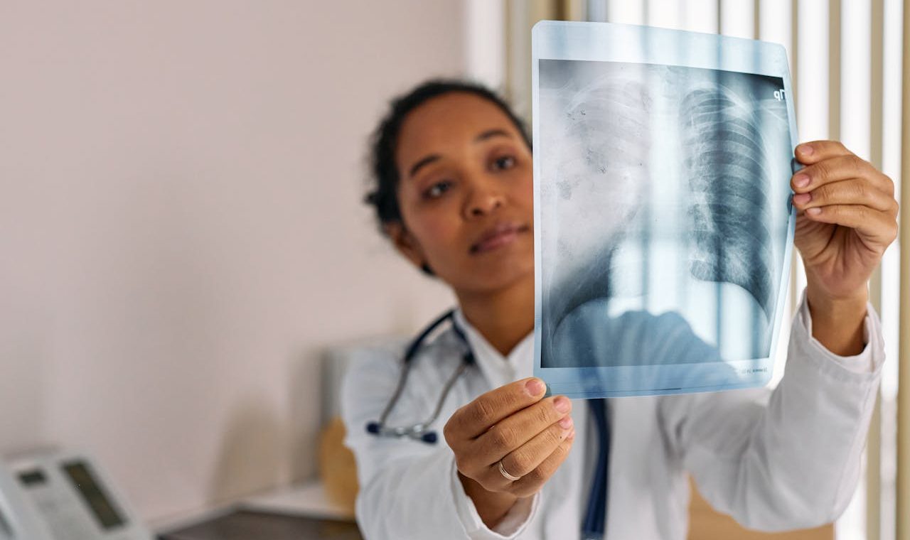 Flovent and lung function improvement
