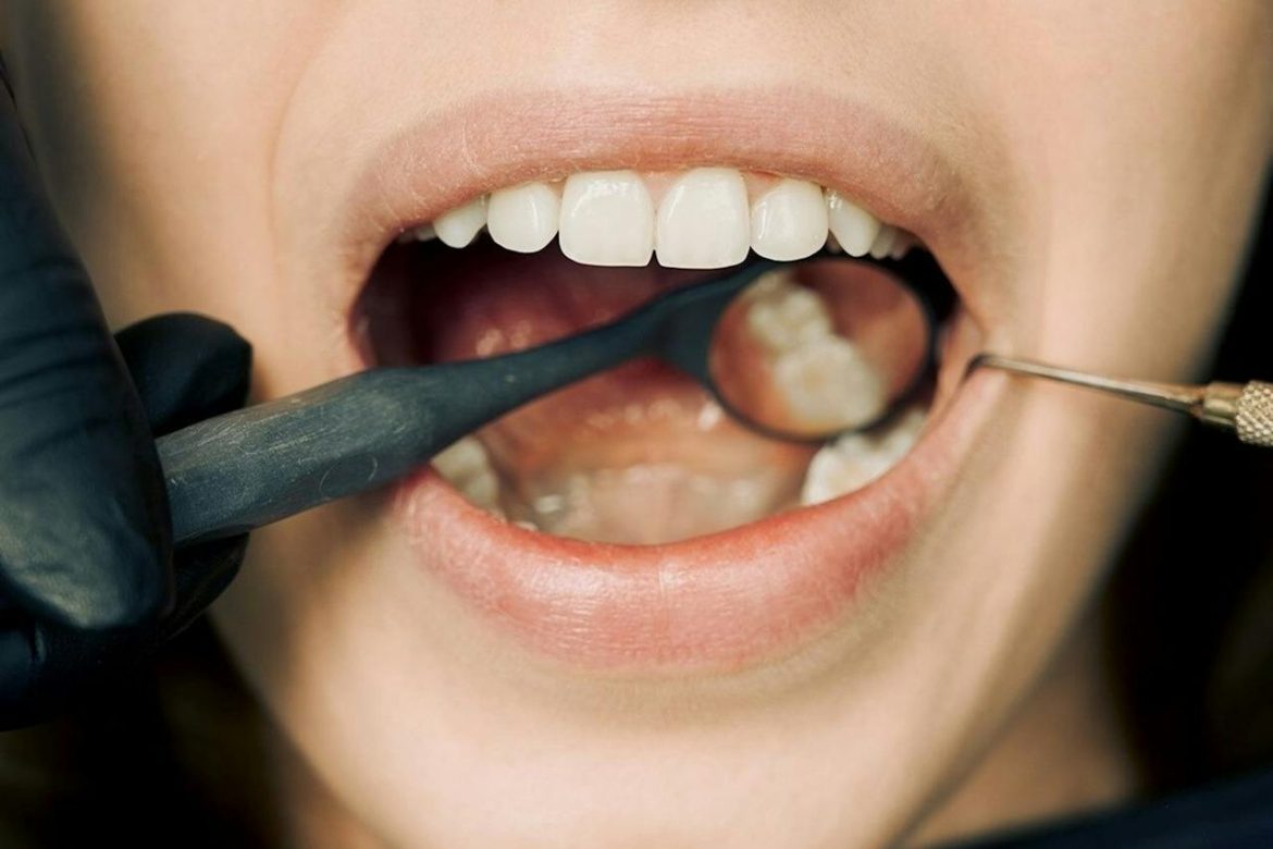 Can Breo Ellipta cause oral thrush