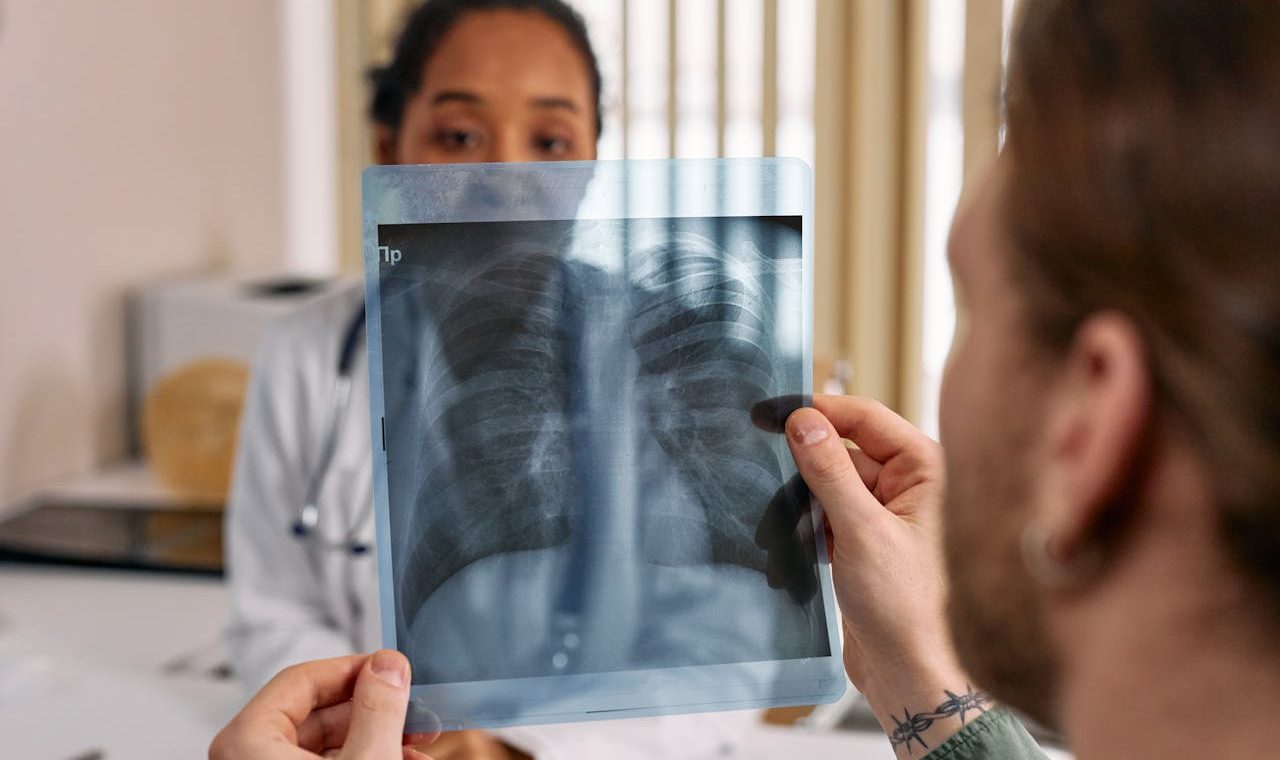 is Breo Ellipta suitable for mild asthma